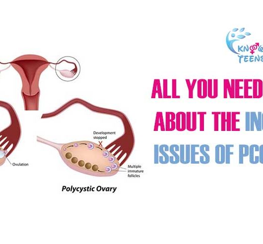 Increasing Issues of PCOD / PCOS